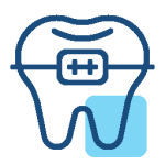 Invisalign Braces